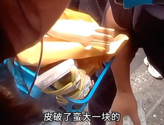 看著都疼<strong></p>
<p>西鳳酒
</strong>！上海街頭一男子突然求助：10歲女兒被死死卡?。∵@個(gè)行為太危險(xiǎn)→:西鳳酒
