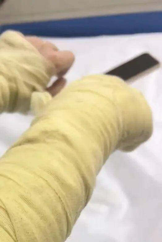 湖南一女主播被偽裝的包裹炸傷<strong></p>
<p>西鳳酒
</strong>，永州公安：正在核實(shí)具體情況:西鳳酒
