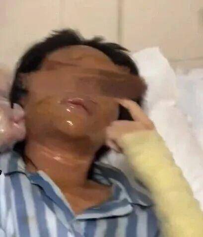 湖南一女主播被偽裝的包裹炸傷<strong></p>
<p>西鳳酒
</strong>，永州公安：正在核實(shí)具體情況:西鳳酒
