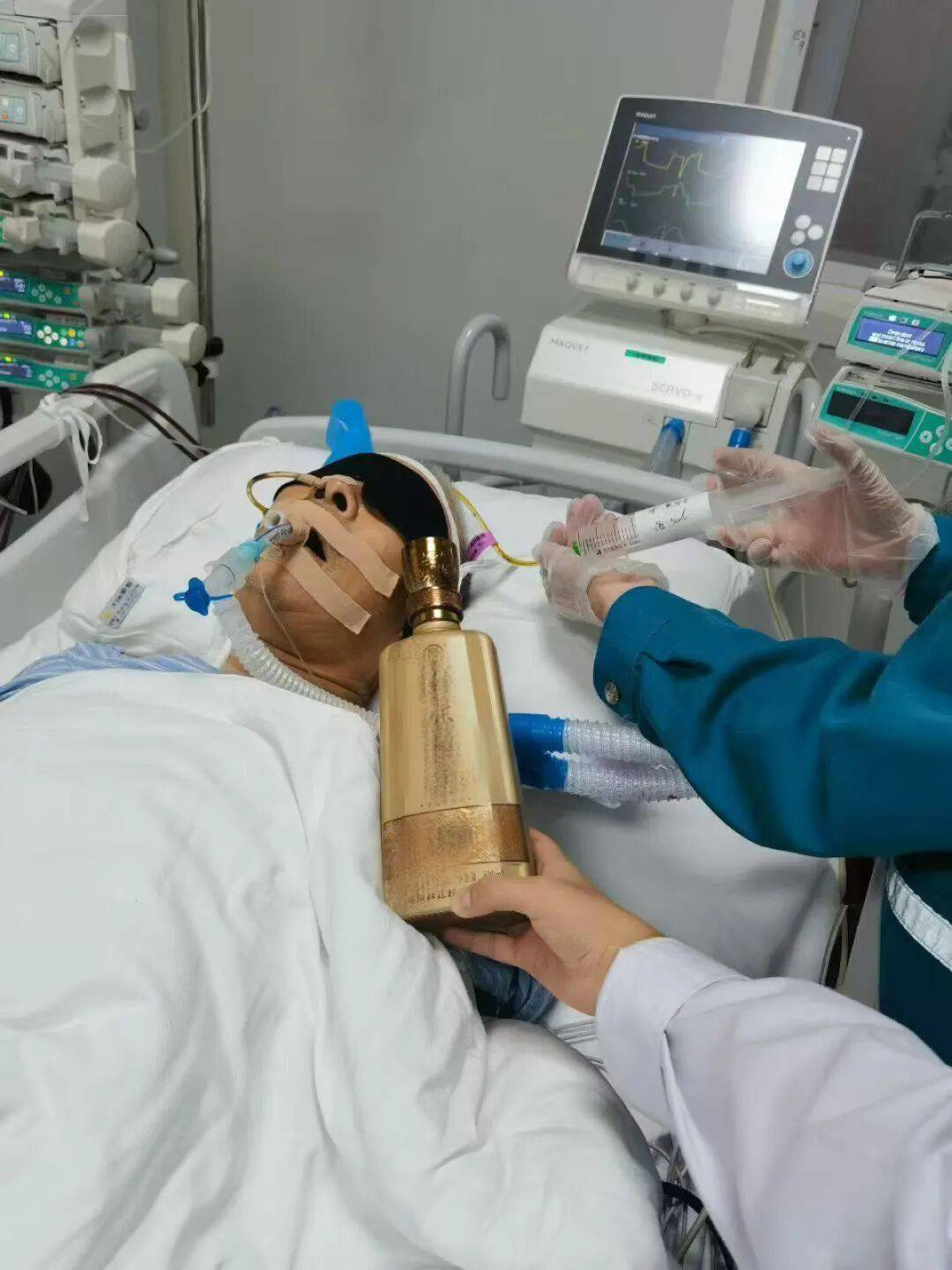 “遵醫(yī)囑<strong></p>
<p>西鳳酒
</strong>，每天喝一斤”！重癥監(jiān)護(hù)室里，醫(yī)生用白酒為68歲大爺續(xù)命:西鳳酒
