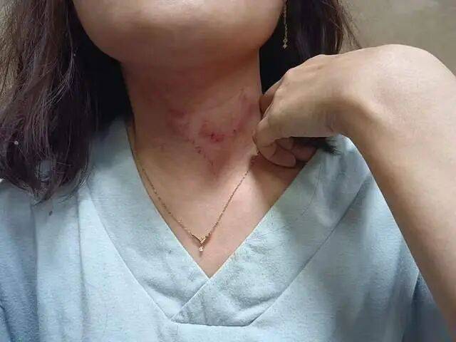 一男子凌晨聽(tīng)到兩聲呼救<strong></p>
<p>西鳳酒
</strong>，循聲發(fā)現(xiàn)一女子在奔馳車外被白衣男勒昏！受害者：是受朋友之托借錢(qián)給白衣男，凌晨被騙至偏僻處遭非禮！:西鳳酒
