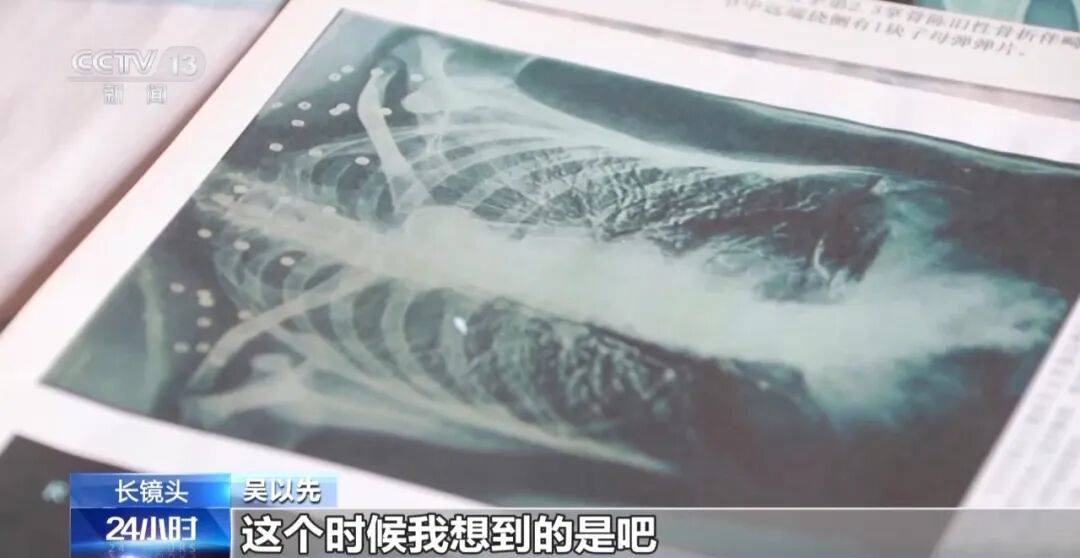 “老先生<strong></p>
<p>西鳳酒
</strong>，您把項鏈取下來再做CT”“你看是不是彈片”:西鳳酒
