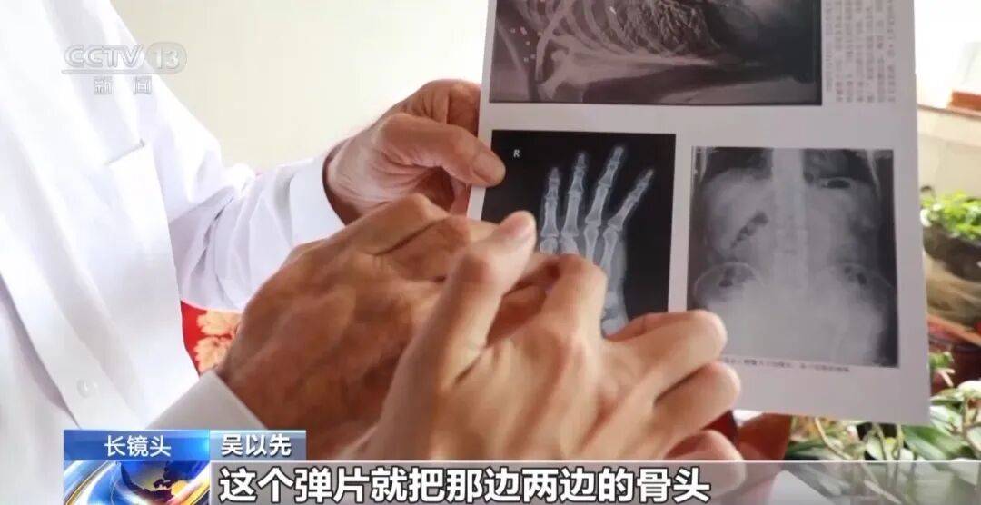 “老先生<strong></p>
<p>西鳳酒
</strong>，您把項鏈取下來再做CT”“你看是不是彈片”:西鳳酒
